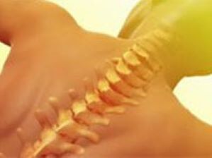 Остеохондроз - заболевание позвоночника